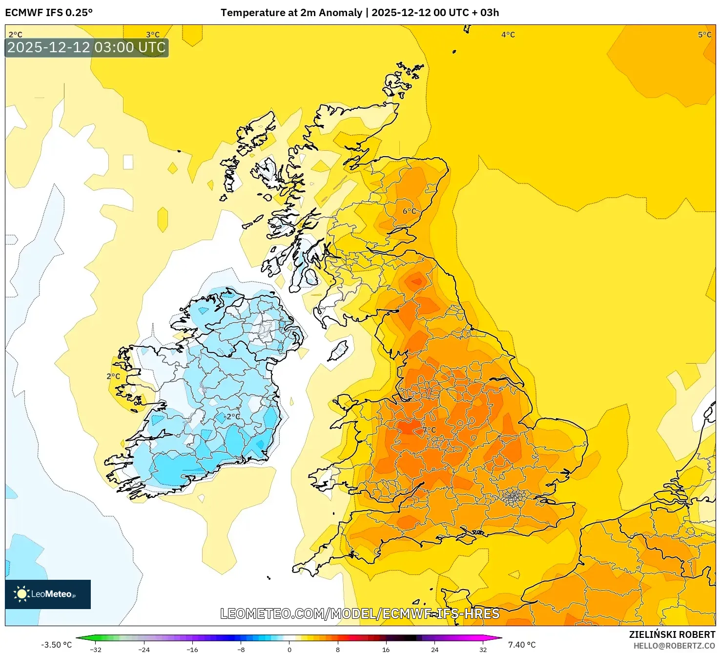ECMWF IFS 0.25° model - United Kingdom, Anomali Suhu 2 m