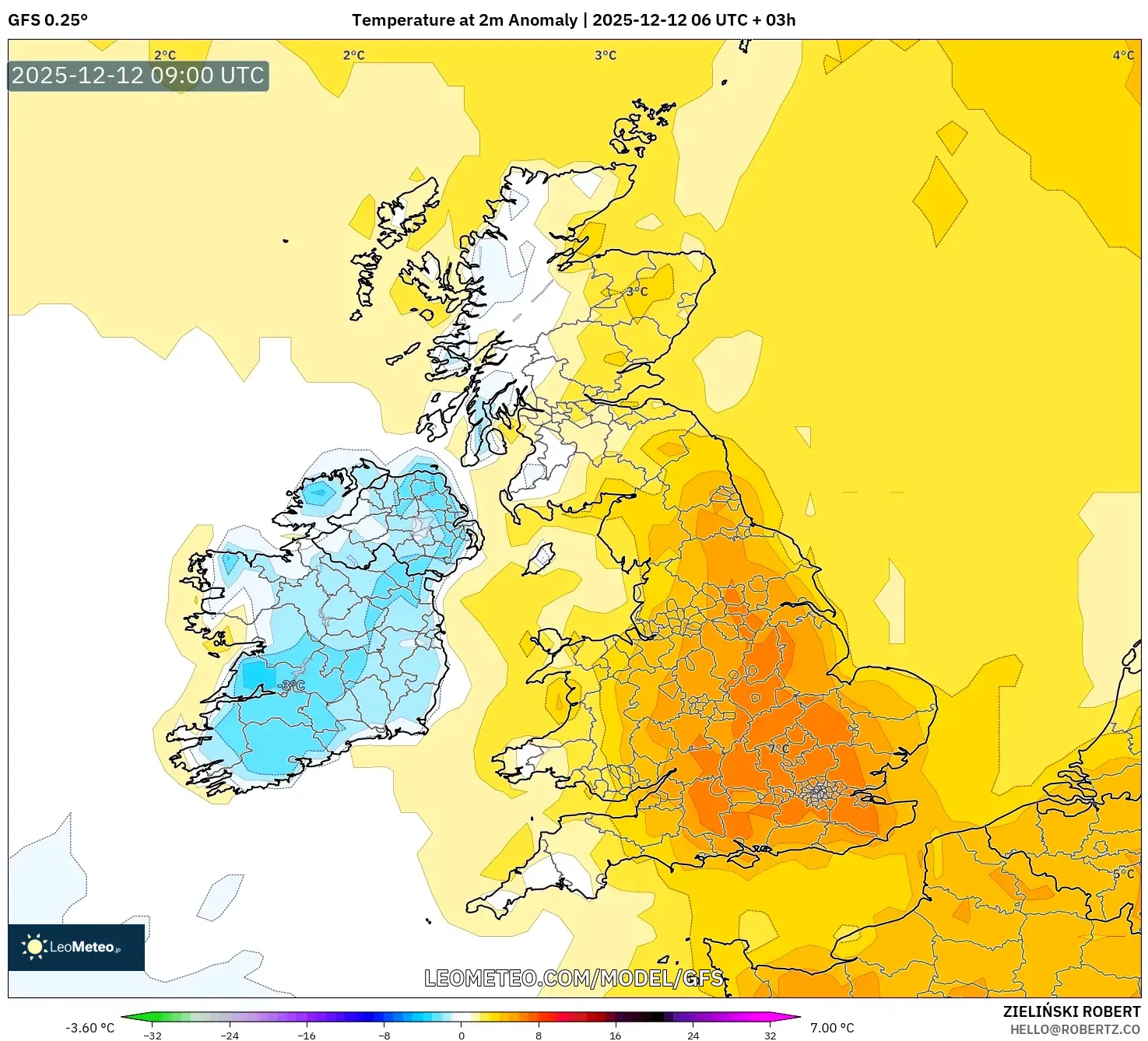 GFS model - United Kingdom, Anomali Suhu 2 m