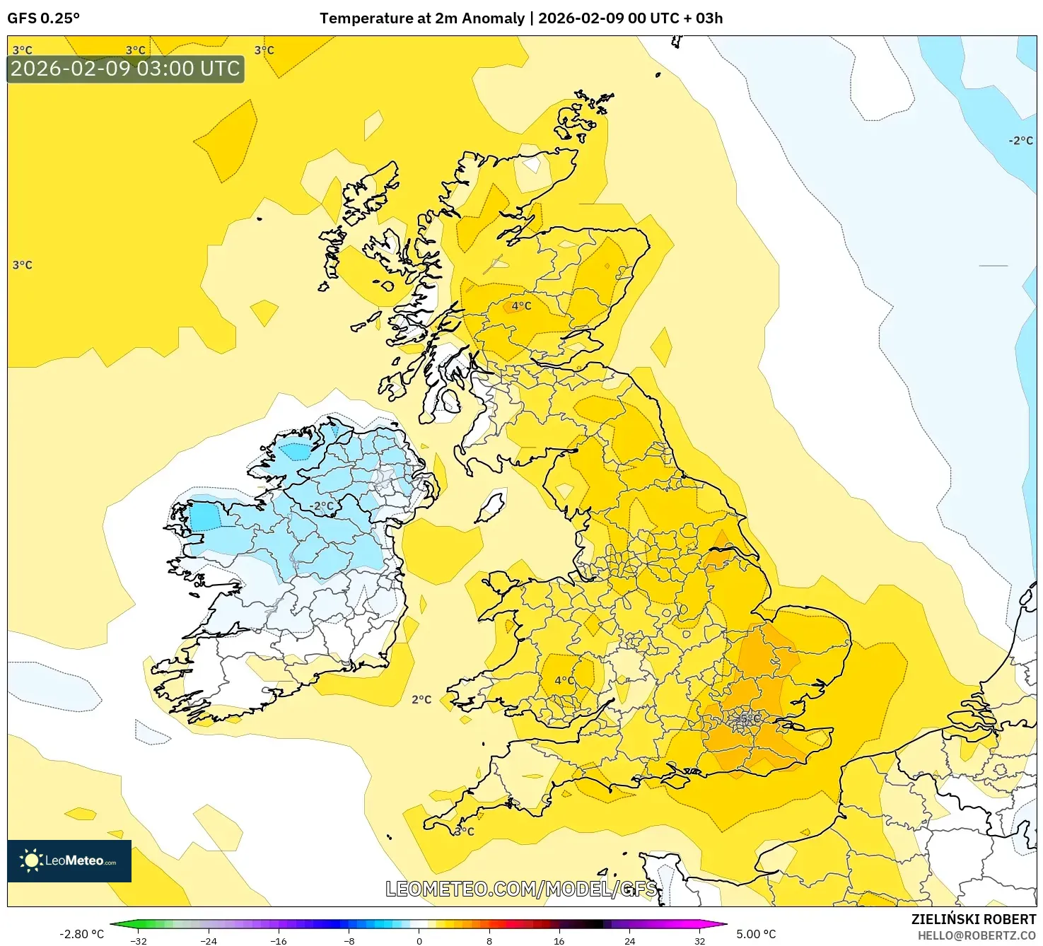 GFS model - United Kingdom, Anomali Suhu 2 m