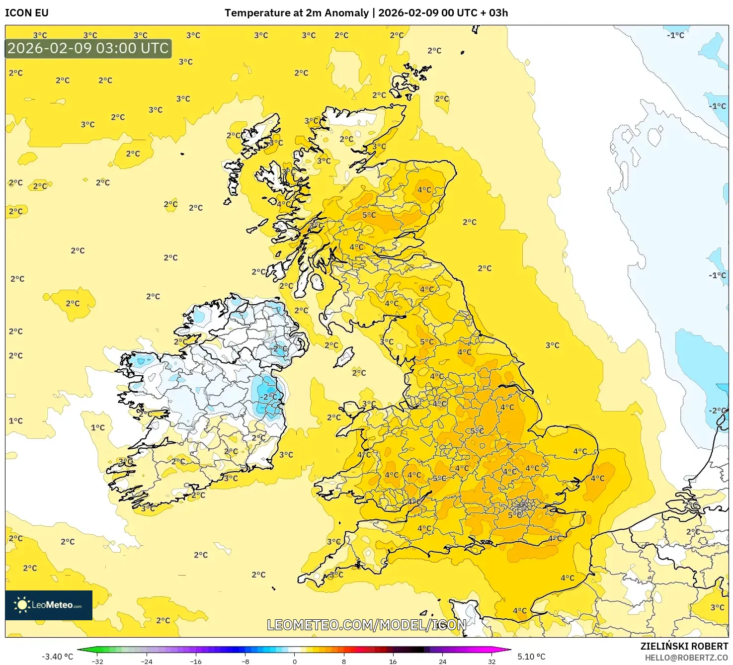 ICON model - United Kingdom, Anomali Suhu 2 m